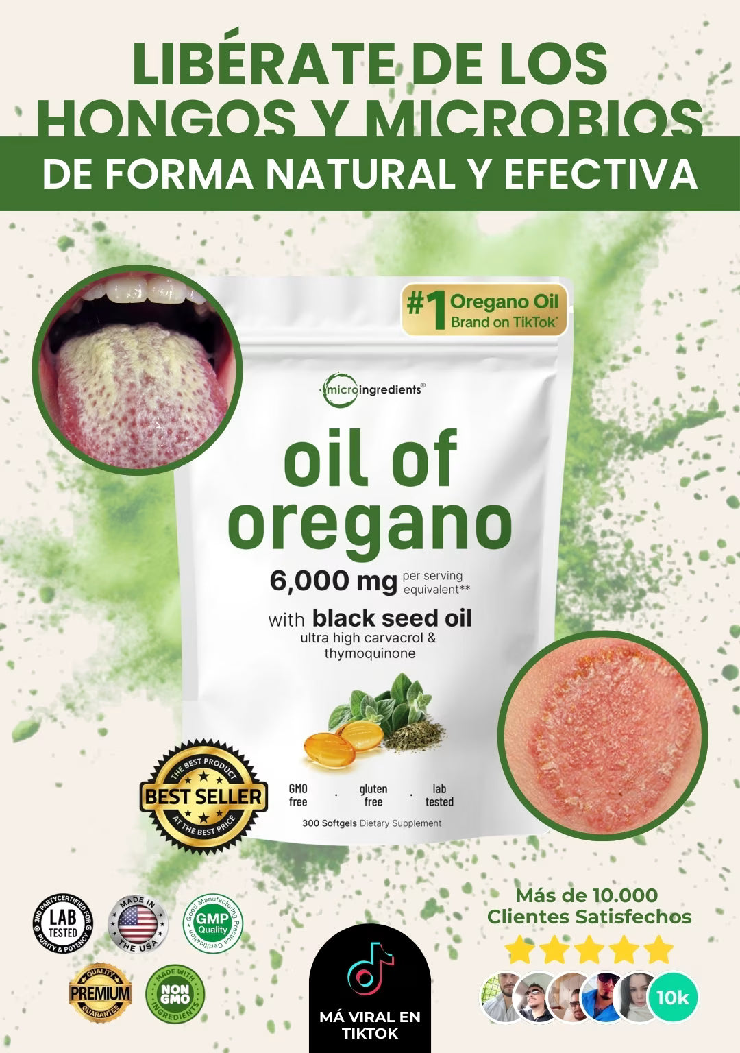 El Antibiótico Natural Más Poderoso - Oil Of Orégano
