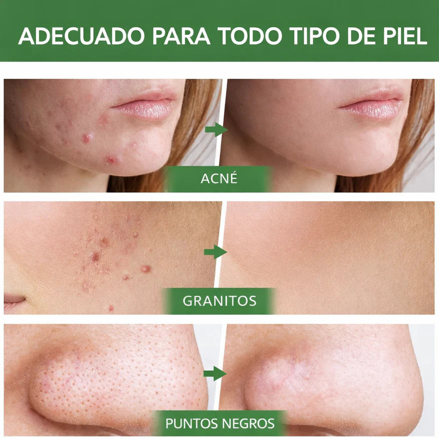 Green Mask Stick – Limpieza profunda, purifica y controla la grasa