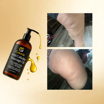 Aceite Anticelulitis Reafirmante Celuvia
